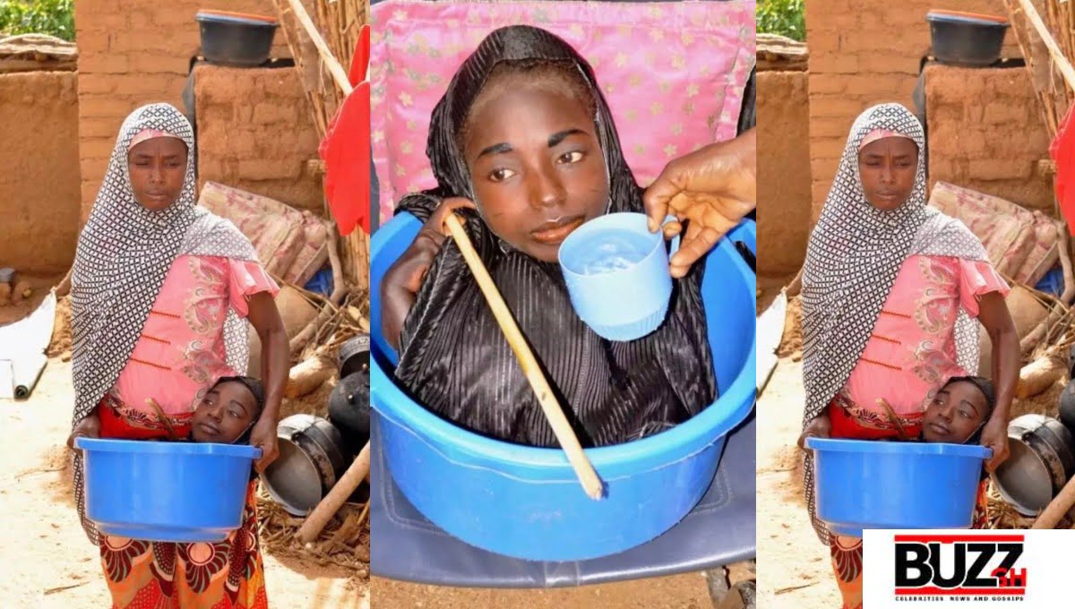 Meet The 19-year-old Girl Who Lived Her Whole Life In A Plastic Bowl - Photos