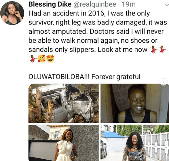 Pretty lady narrates how she survived a horrible accident in 2016 and how far God has brought her (photos)