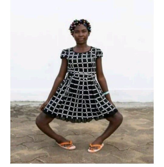 "They called me a witch" Bowlegged lady shares story after life-changing operation (photos)