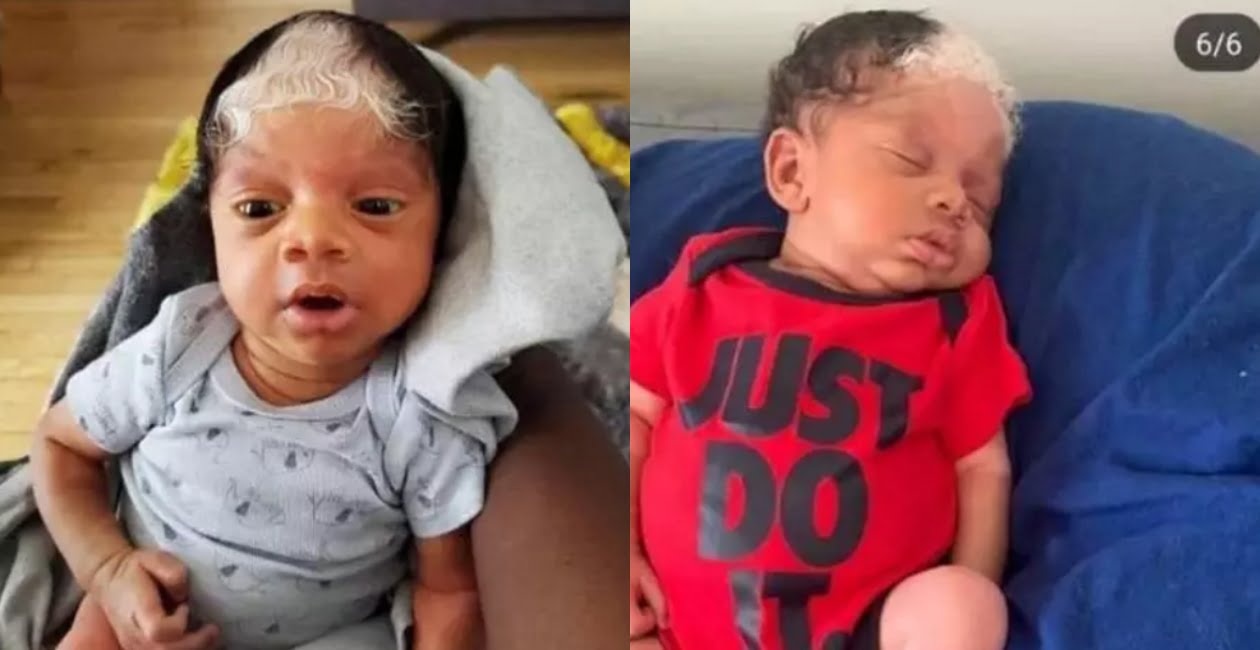 Meet The Cute Black Baby Born With Black And Grey Hair - Photos