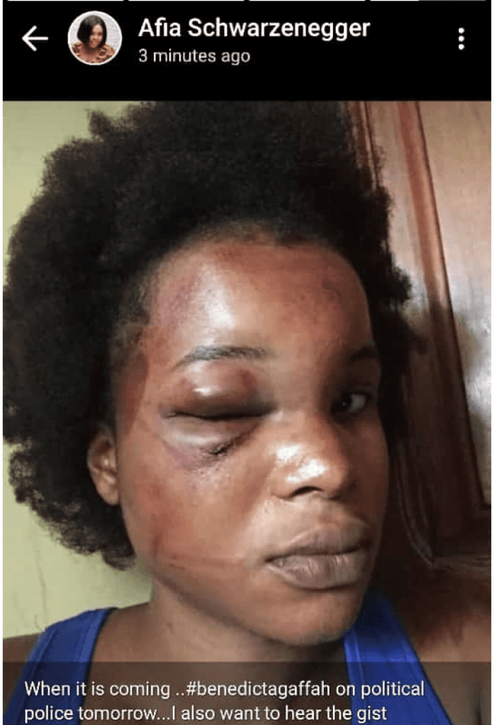 Benedicta Gafah finally details how She was beaten up by Her then Husband - Video