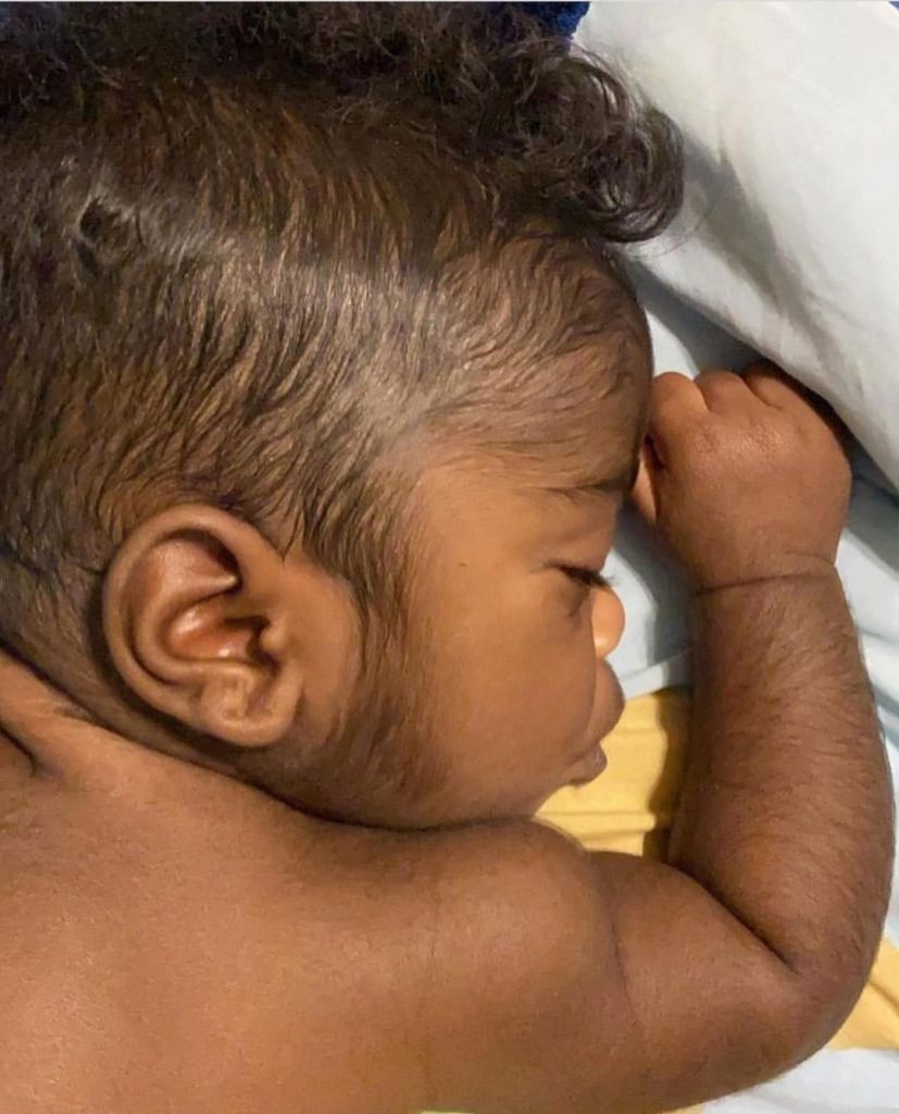 Hairy 5 months old baby causes stir online (photos)
