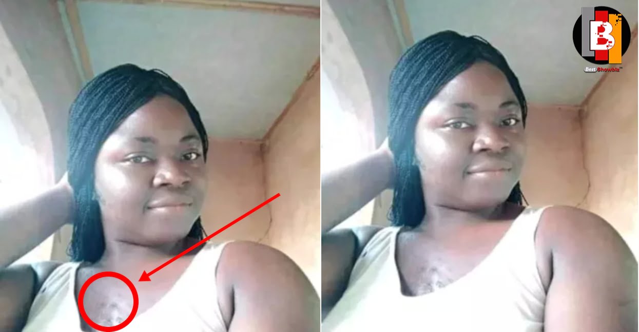 "Guys Avoid Me Because of my hairy chest" - Lady Cries Out Online