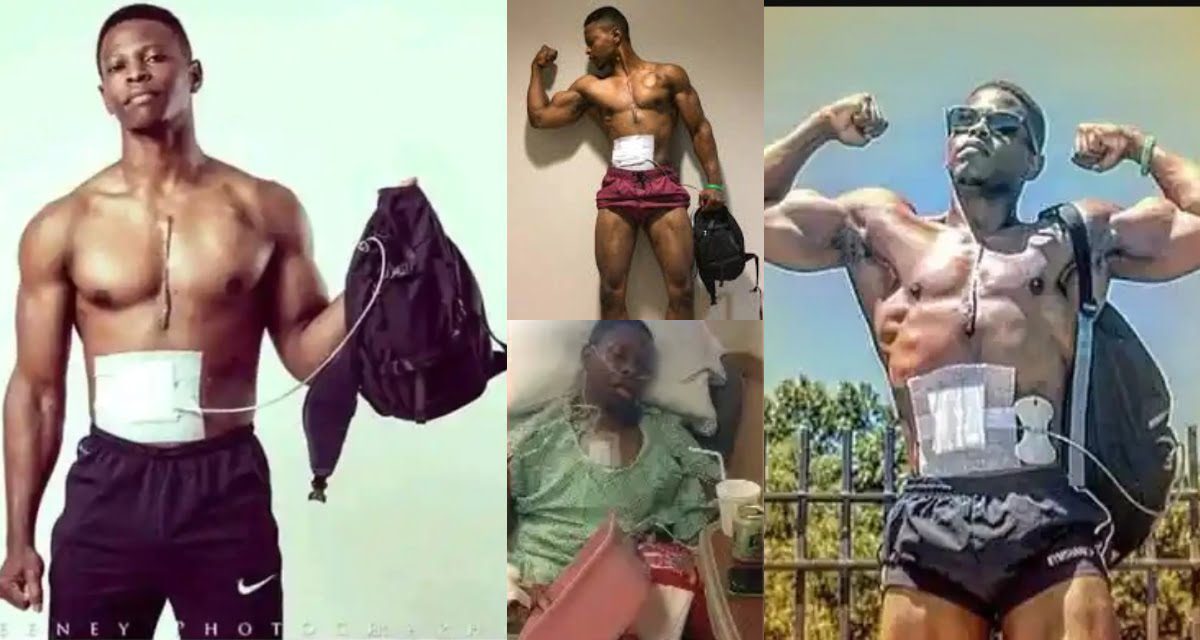 Meet Andrew Jones, a fitness model who carries his heart in a bag pack (Photos)