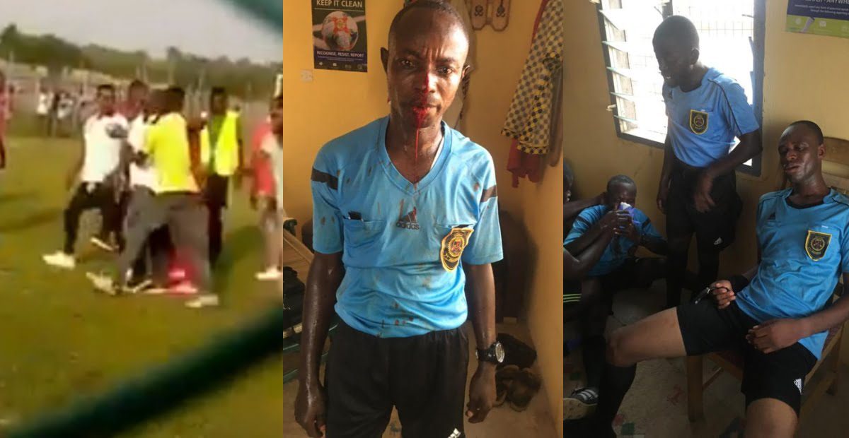 Referee beaten by fans and loses all his teeth in a division one match over bad officiating.