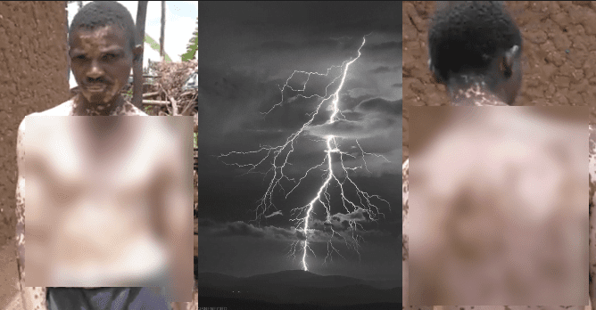 Man Begins to turn white after Thunder struck him (photos+video)