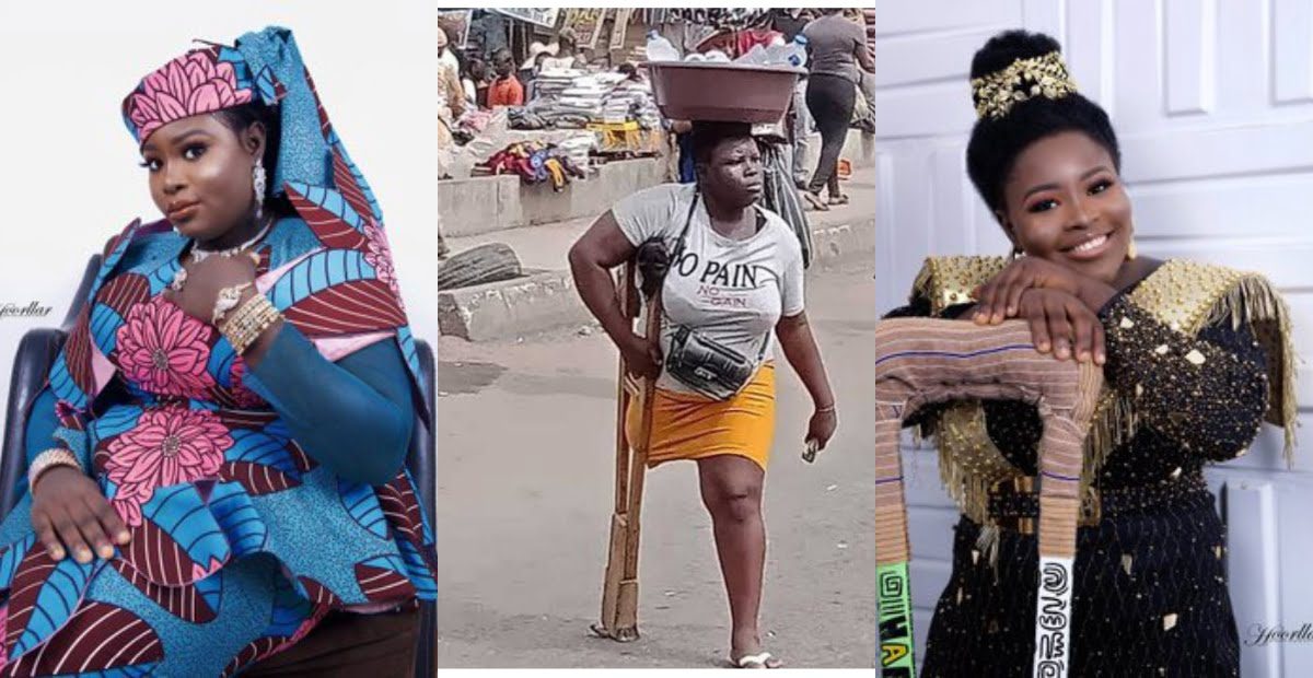 See how money has transformed the amputee water seller who went viral.