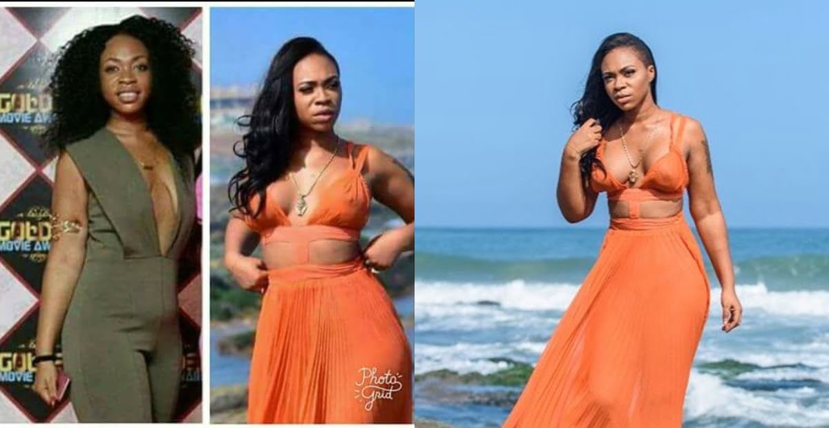 Pictures proving Michy has done a breast surgery circulates on social media.
