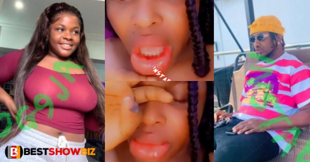 Video: Beautiful Lady narrates how her boyfriend brutalized her for returning home late from work