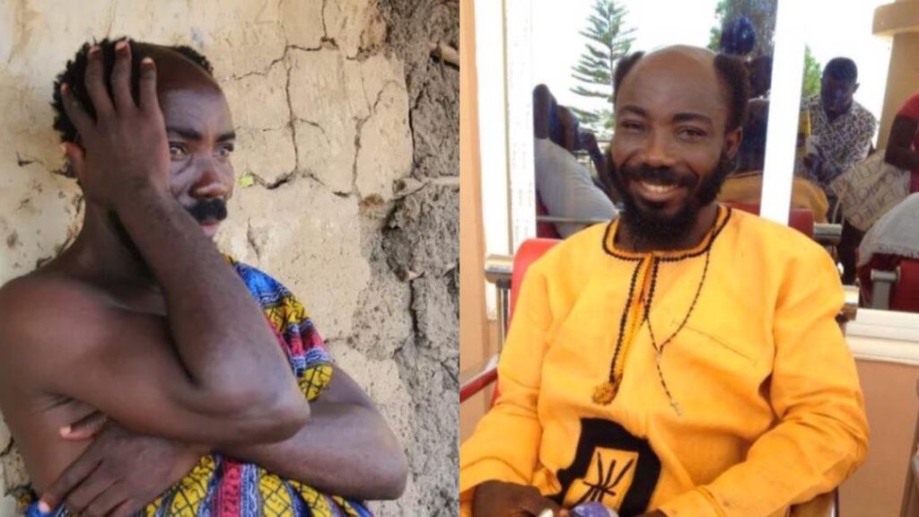 My own mother killed my father - Actor Big Akwes reveals