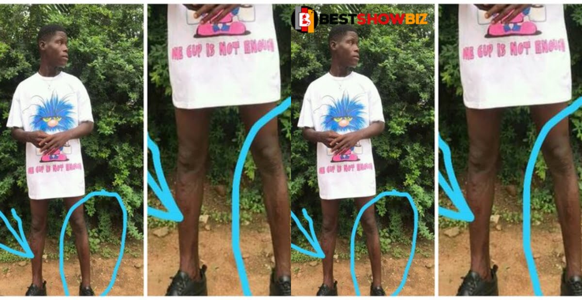 "Too many scars"- Ghanaians Blast Atemuda for Joining No jeans challenge (photos)