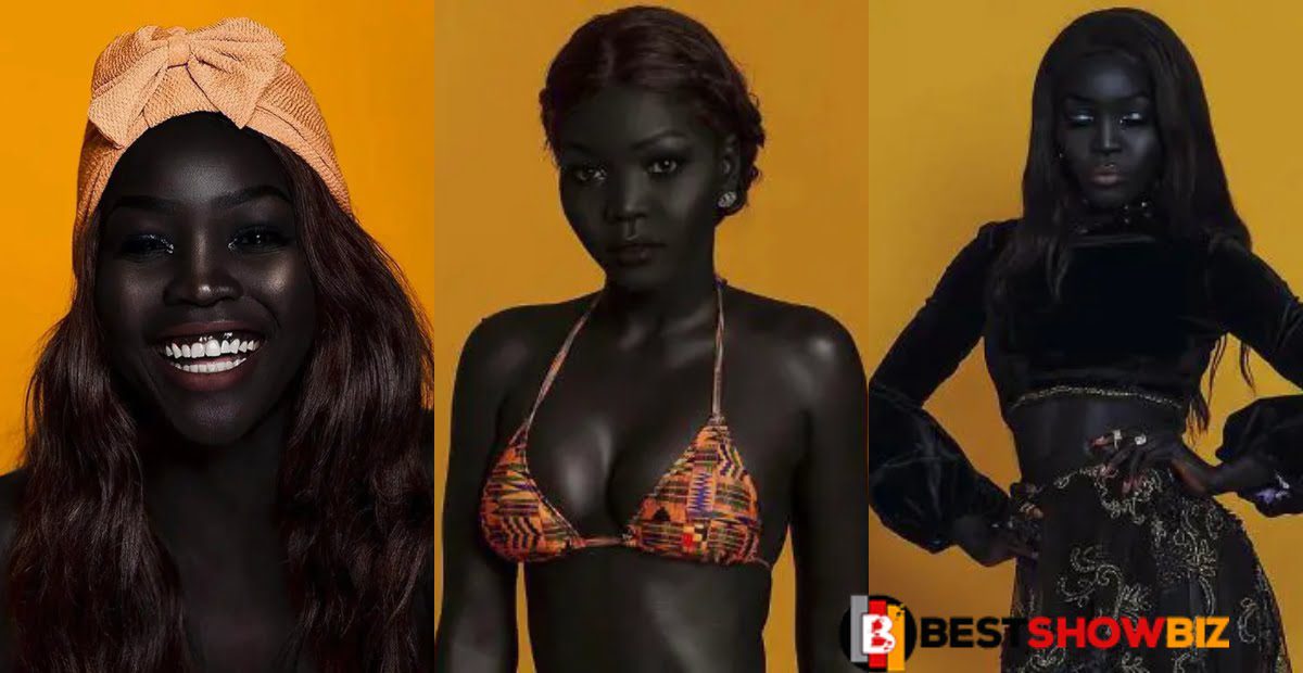 Black is beautiful: See more photos of Nyakim, the darkest girl in the world