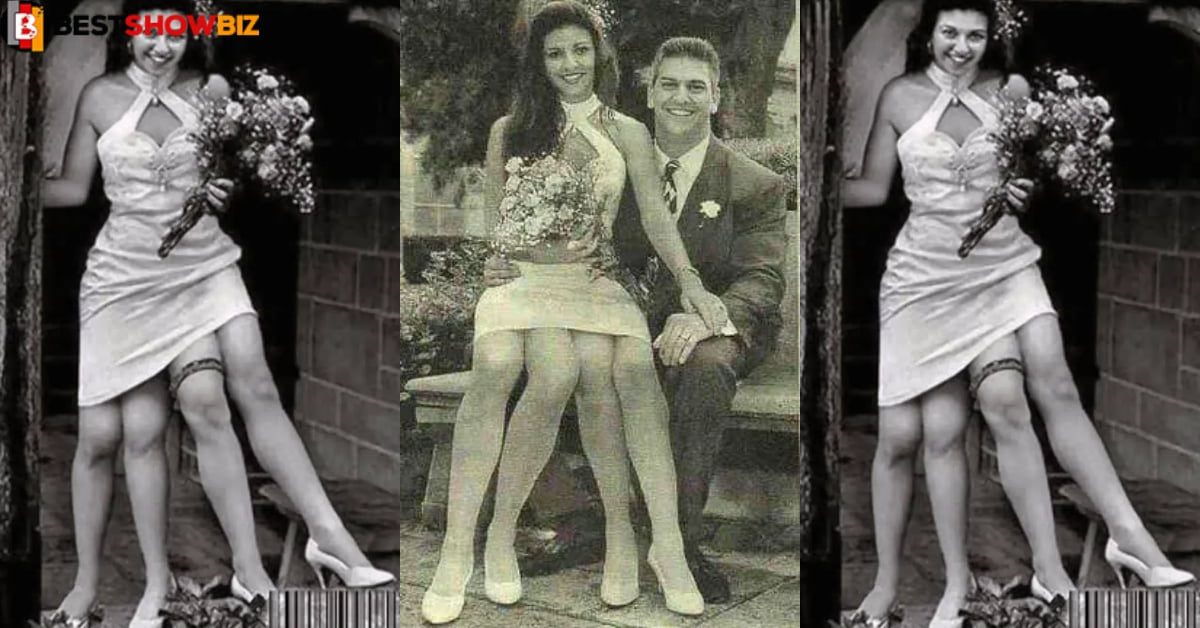 4 legs, 2 genitals, yet this woman was happily married with 5 kids (photos)