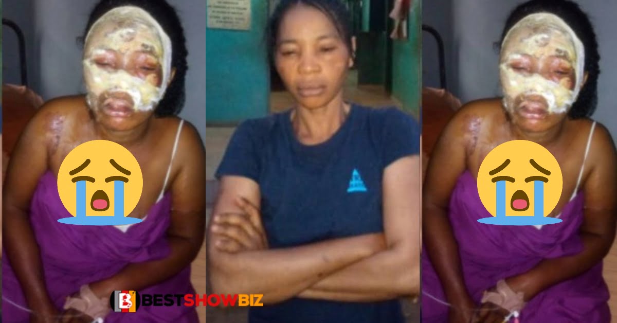 Jealous wife pours hot water on her fellow woman for sleeping with husband