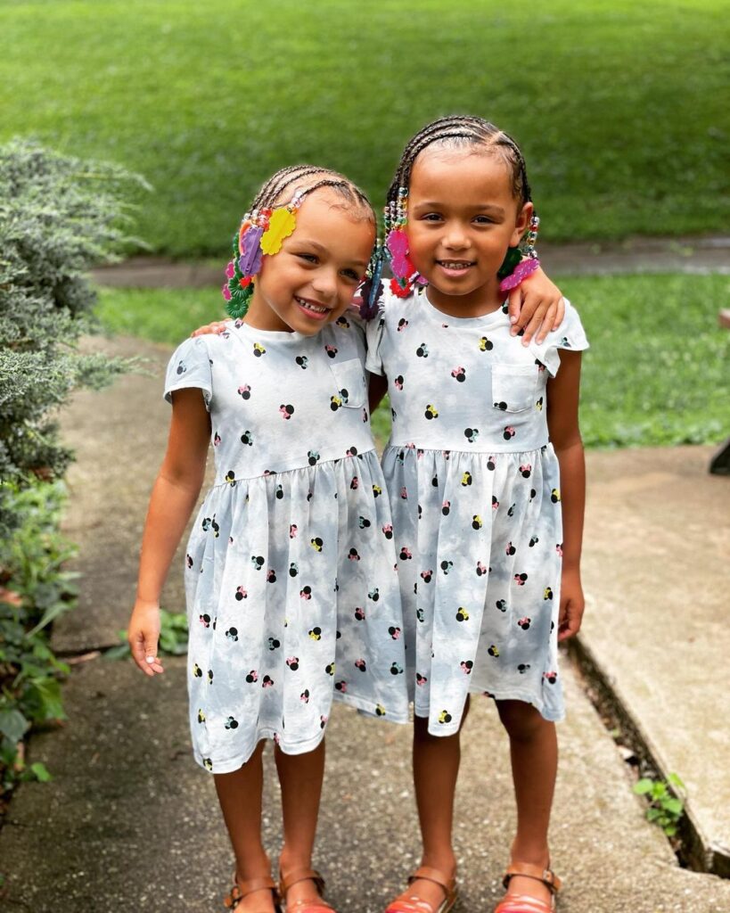 Meet the beautiful Twin girls with rare black and white skin colors - Photos