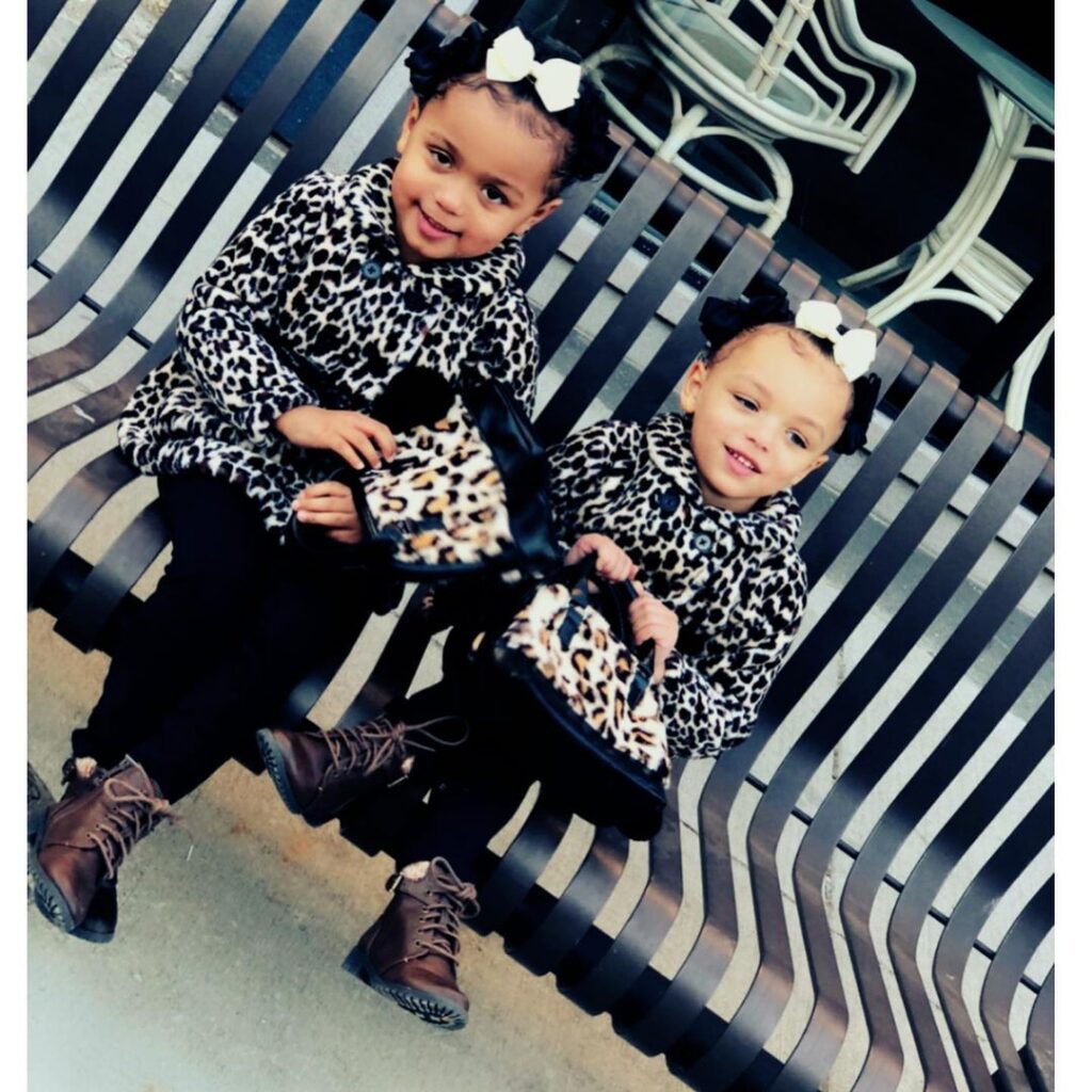 Meet the beautiful Twin girls with rare black and white skin colors - Photos