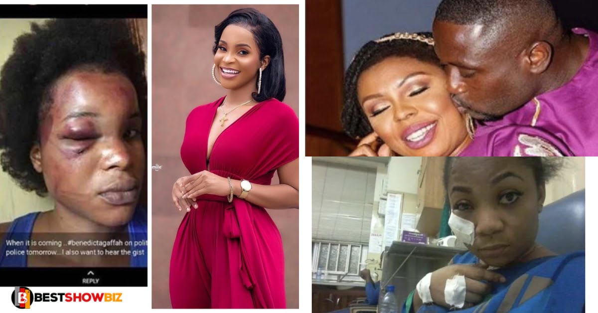 Meet 4 popular female celebrities who were abused by their boyfriends years ago - Photos