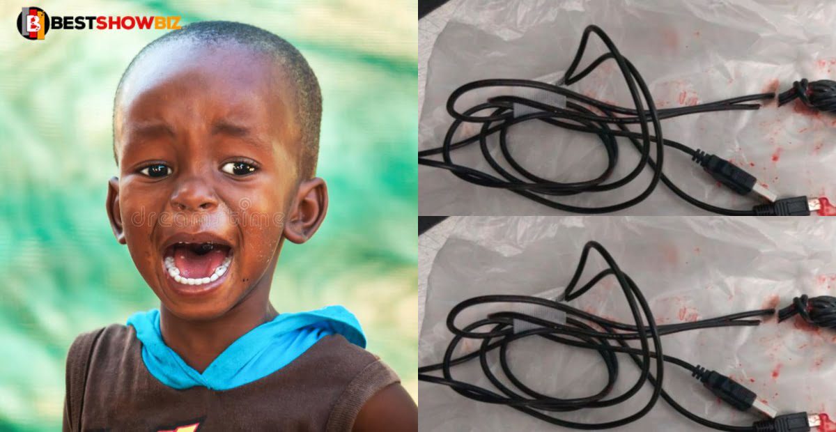 15 years old boy in trouble, after USB cable gets stuck in his pen!s; he inserted it to measure how long his 'P' is