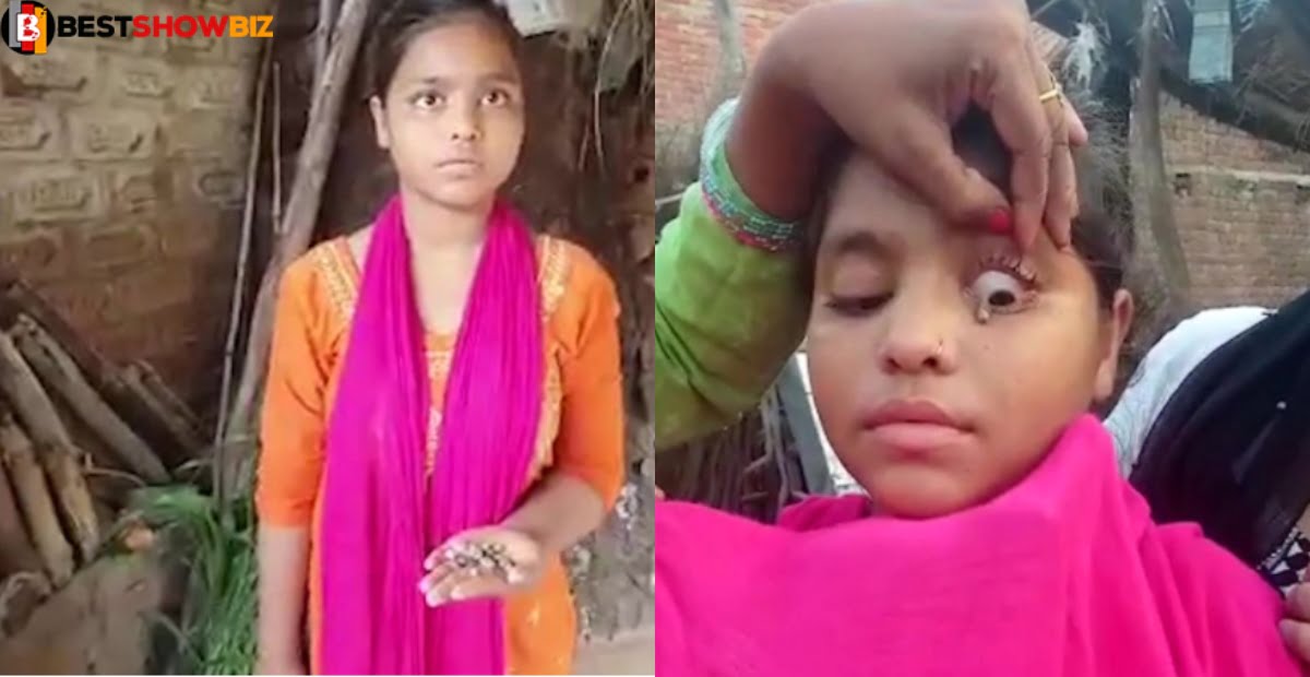 Unbelievable: Doctors Shocked as girl's tears turn into stones (photos)