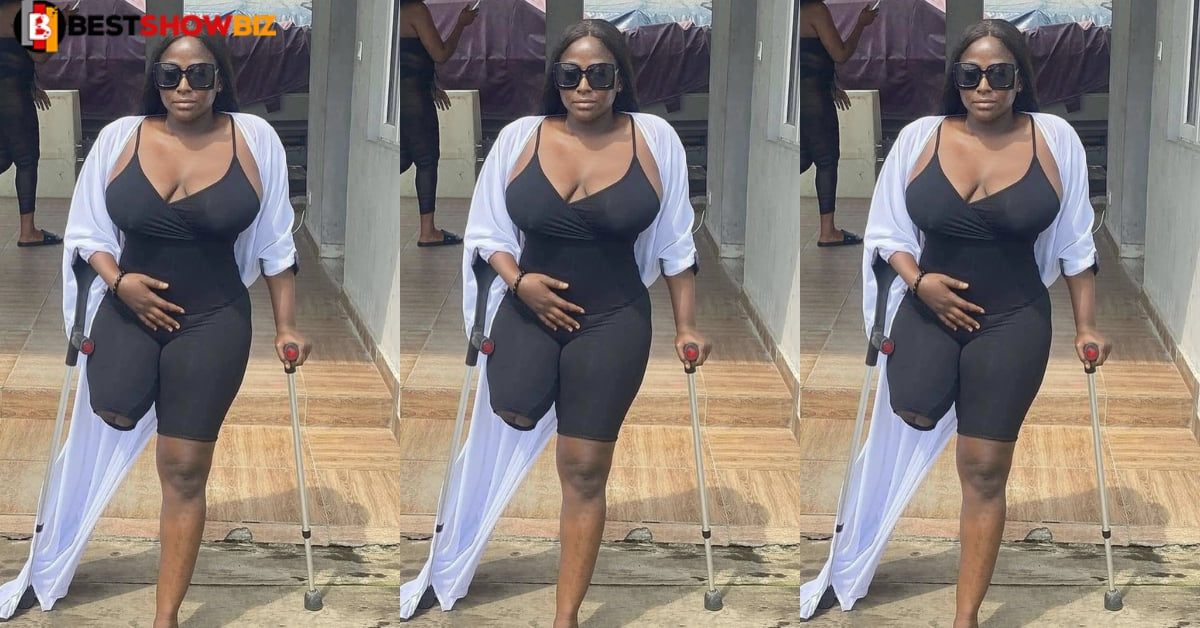 See photo of the beautiful amputee lady trending online