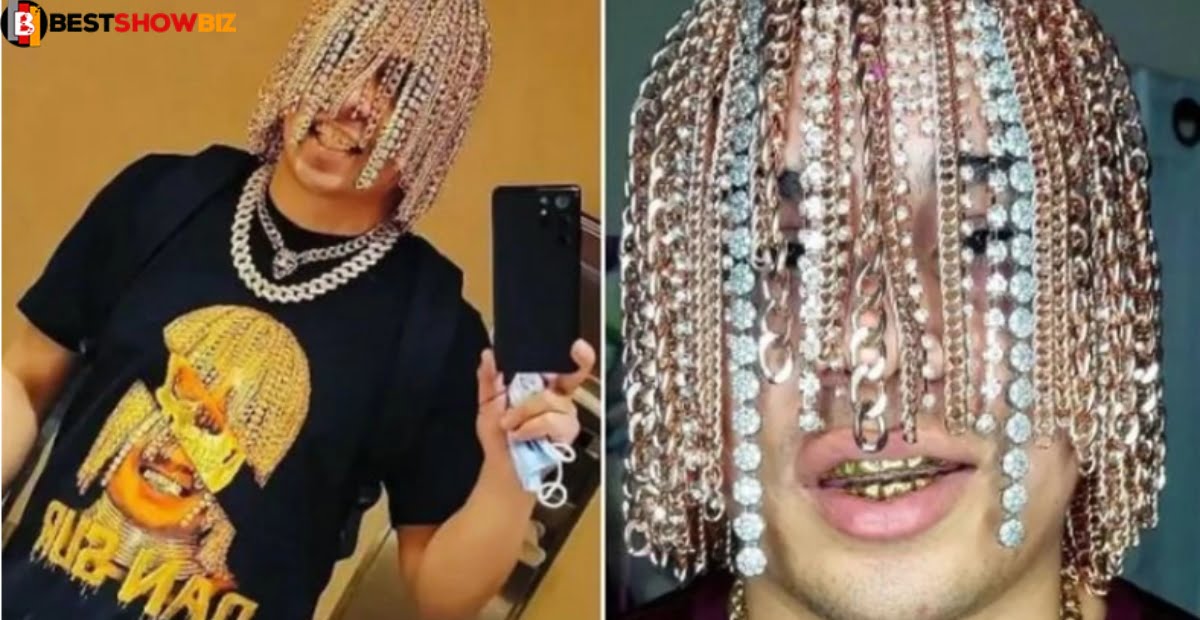 rapper gets gold chains surgically implanted on his head to give him a new appearance.