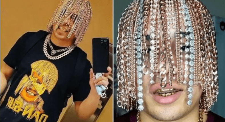 rapper gets gold chains surgically implanted on his head to give him a new appearance.