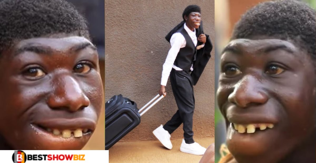Video: See the massive transformation of the boy who was bullied and called mṑnkey