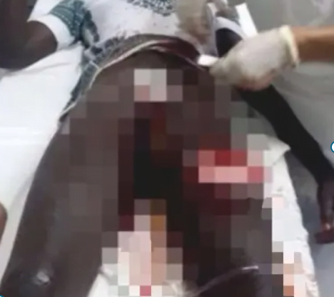 Central Region: 28-year-old man arrested for cutting the manhood of his friend, see why...