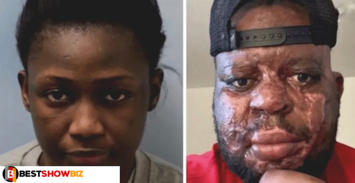 28-year-old Ghanaian-UK based lady pours acid on boyfriend's face, sentenced to 14 years in prison