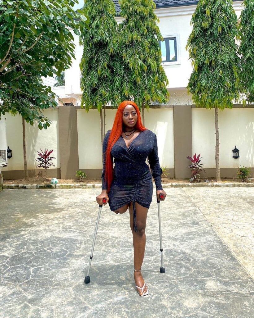 Meet the beautiful amputee actress making it big in life - Photos + Videos