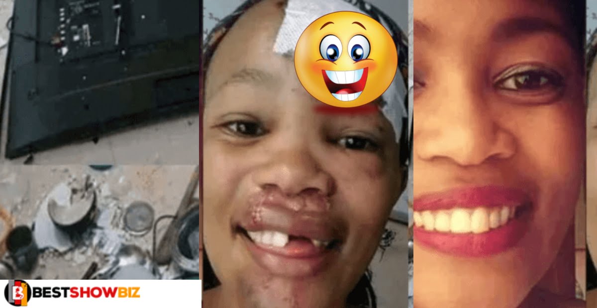 Boyfriend removes the teeth of his girlfriend after the girl destroyed his room for cheating on her.