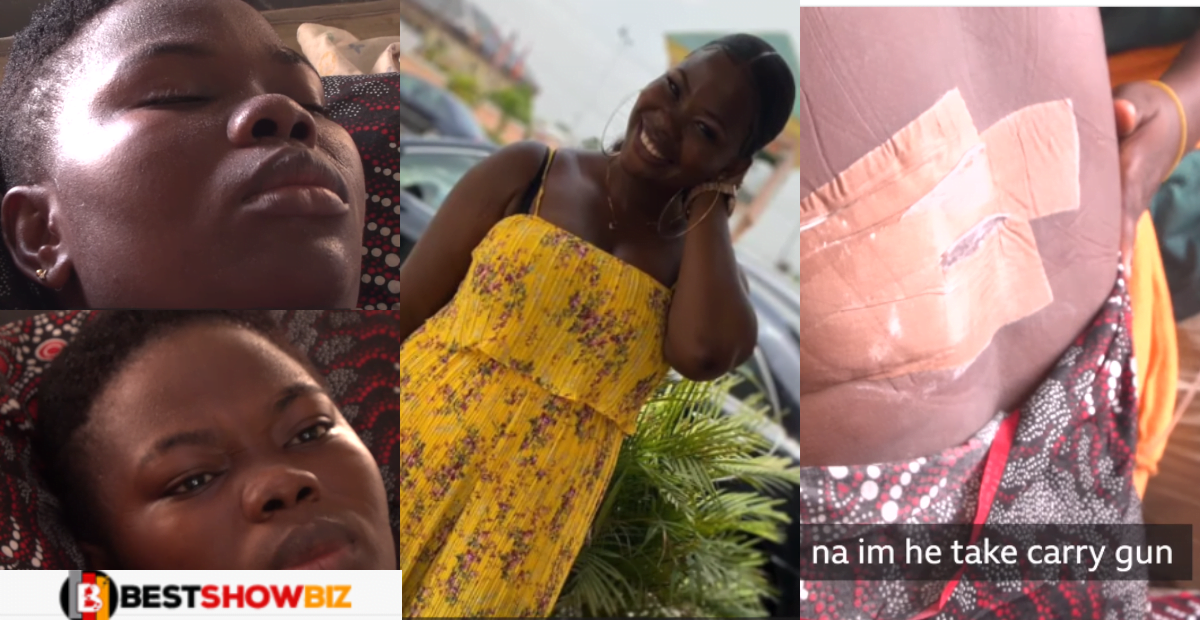 "My boyfriend shot me when i told him we have to break up"- lady shares sad story (Video)