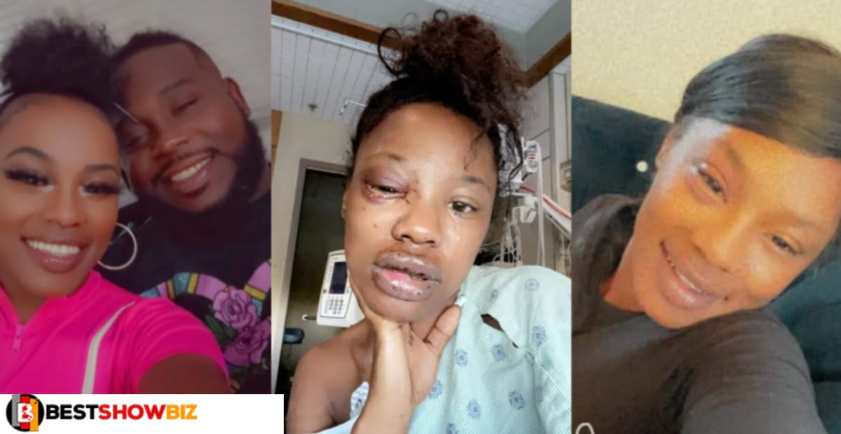 I will still choose him - Woman who was bḕaten brutally by her boyfriend goes back to him