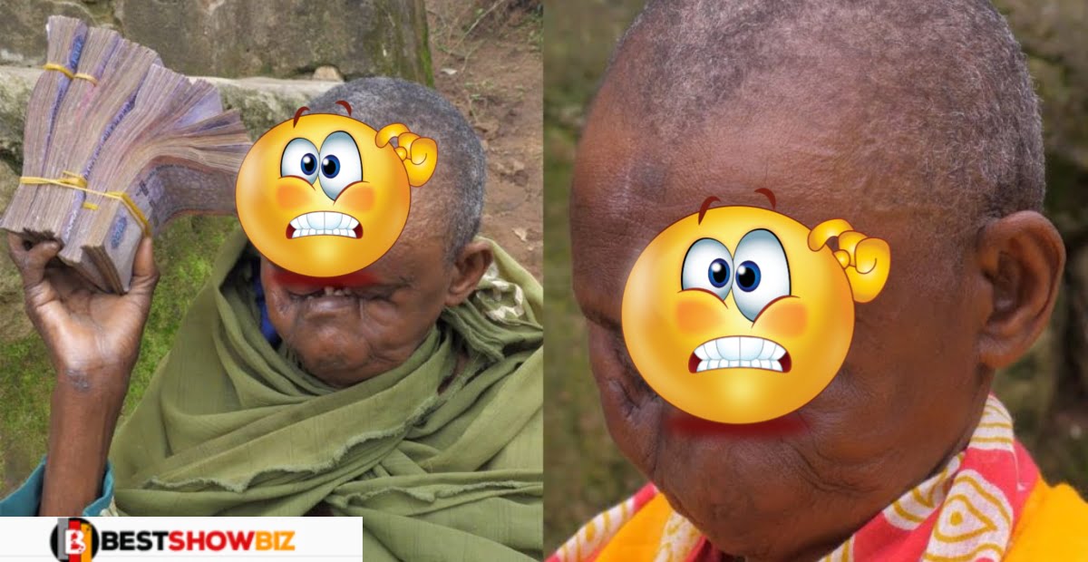 God is Great: Watch Video of a 77 years old woman called Amina with No face (video)