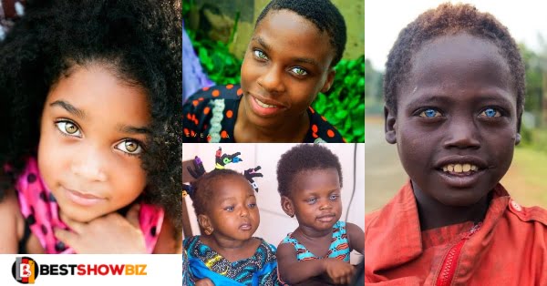see 5 photos of African kids with beautiful Coloured eyes