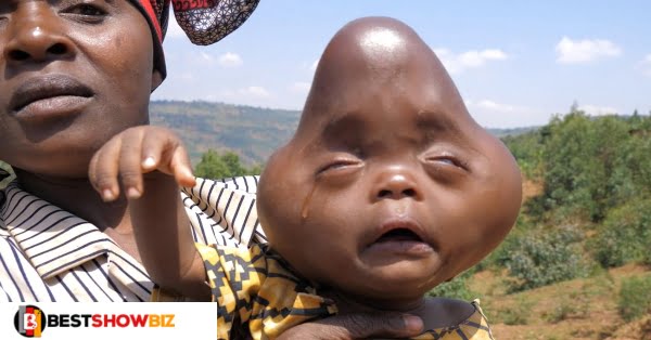 "My husband told me to K!ll our baby, because of how he looks" - Mother cries (Video)
