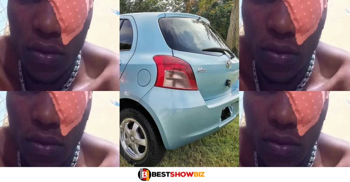 28-year-old man loses his left eye over a car fight - Photos
