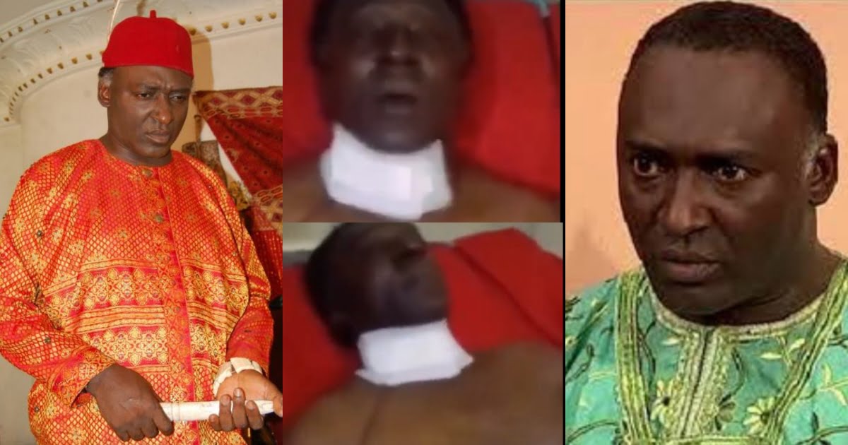 Popular actor, Ohameze, survives spinal cord surgery, This was what he said after coming out of the surgery room (video)
