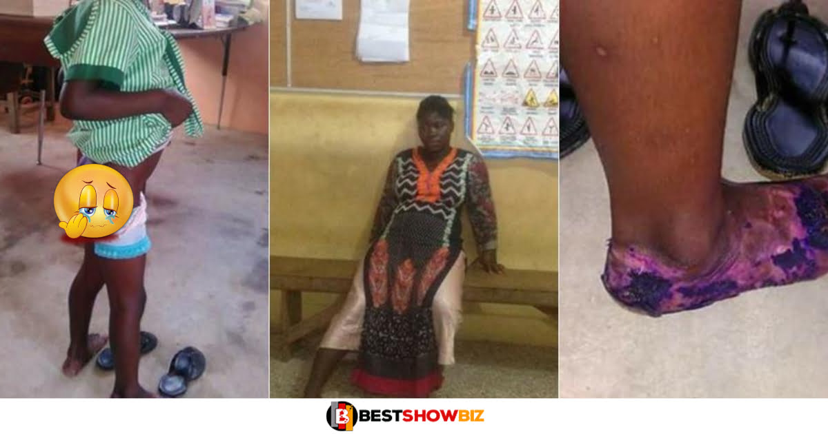 Woman pours hot water her stepchild's private parts as punishment for bedwetting
