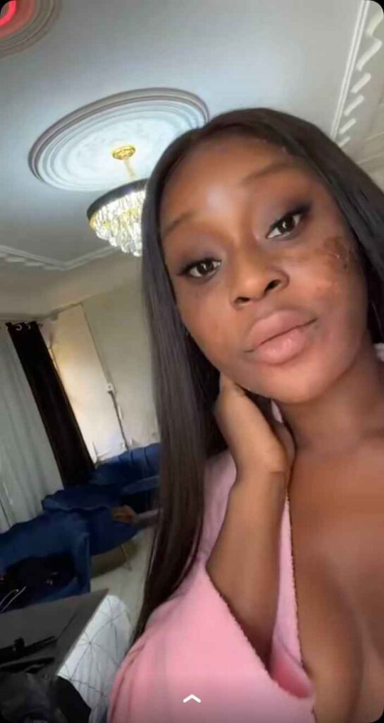 After All The Skincare Products, Efia Odo Goes Into Hiding Over Dying Facial Skin
