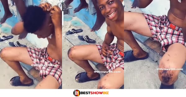 Social Media Reacts after a video of a young boy with plantain skin due to bleaching went viral online (video)