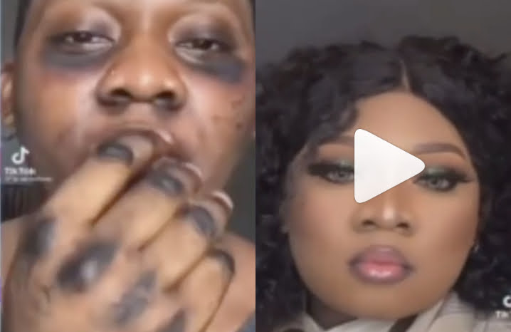 Lady With Plantain Skin Goes Viral Online (video)