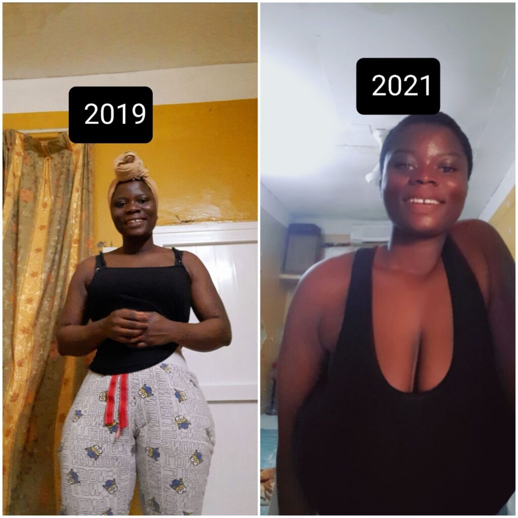 Lady Stirs The Internet With Her Massive Transformation Photos