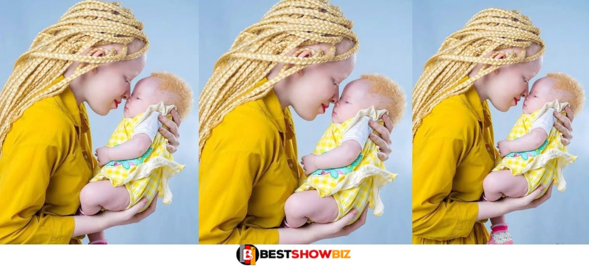 Beautiful Albino woman and her newly born baby stirs the internet in cute photo