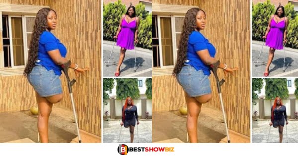 A beautiful lady with one leg writes a touching letter to any man willing to be her future husband