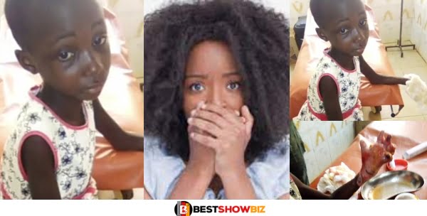 Female Teacher Boils The Hand Of A 9-Year Girl For Allegedly Stealing Gh¢ 2 (Video)