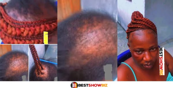 Pains! : Reactions as Lady With Scanty Hair Gets Beautiful Braids (Video)
