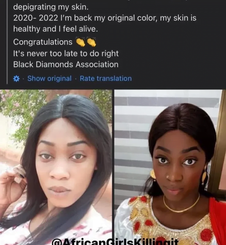 Lady who stopped bleaching for 2 years shares her beautiful dark skin online (photos)