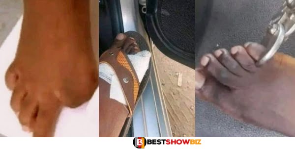 Photos Showing How People Sells Their Toes For Money Drops