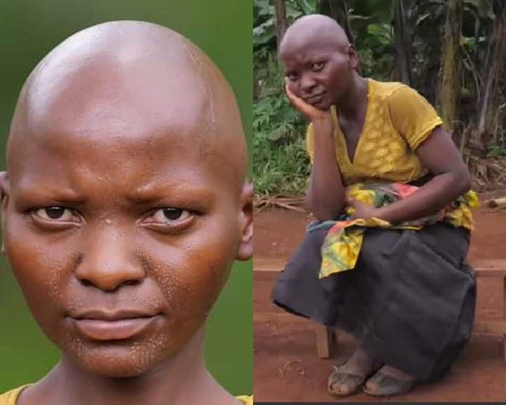My Husband Sacked Me After 2 Months Of Marriage Because I Have No Hair On My Body - Lady Cries Out